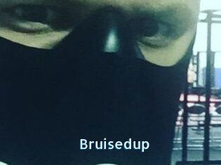 Bruisedup
